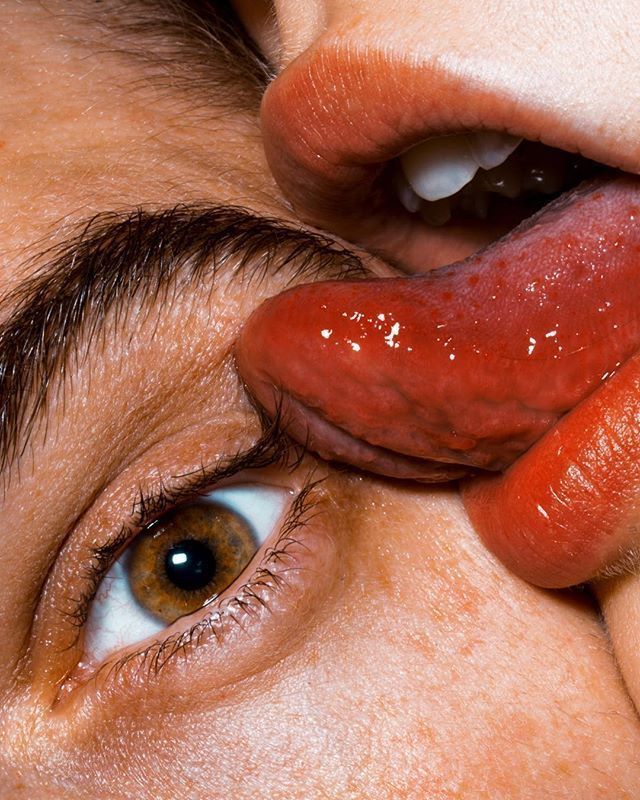 Bacterial Vaginosis and Male-Partner Treatment: A New Approach to Reducing Recurrence